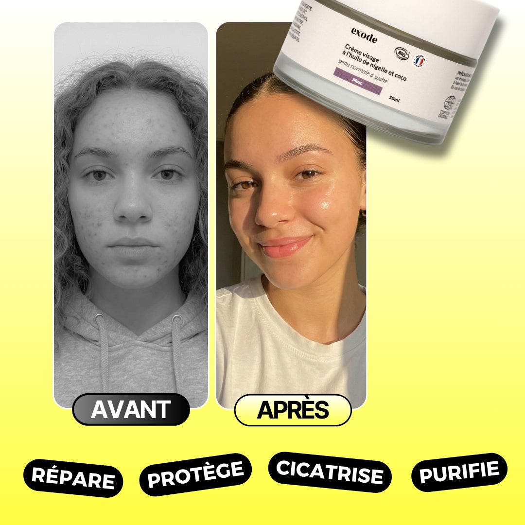 Crème visage à l'huile de nigelle